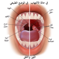 تصغير للنسخة بتاريخ 04:48، 2 مايو 2025