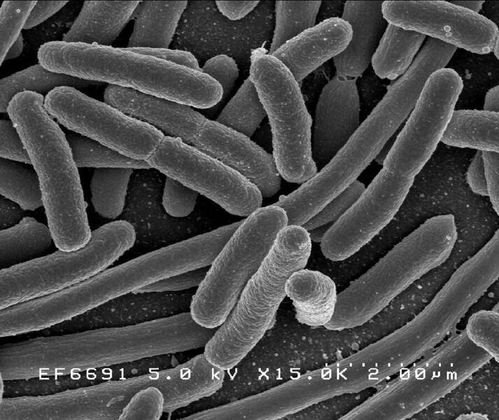 ملف:E. coli Bacteria (7316101966).jpg