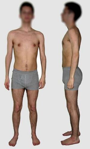 Male borderline underweight.jpg